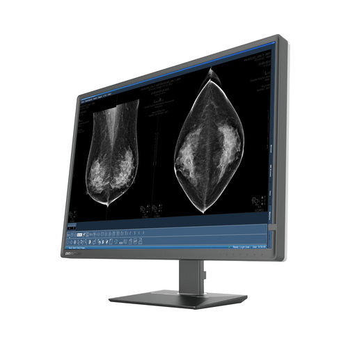 Mammographie-Monitor - C1216W - Shenzhen Beacon Display Technology - für Radiologie / hochauflösend / mit LED-Hintergrundbeleuchtung