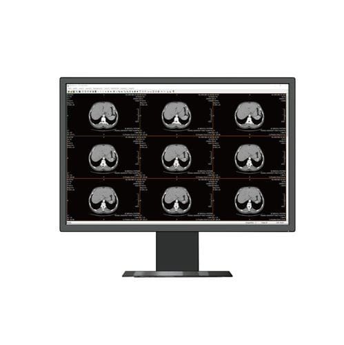 Medizinisch Monitor - HL2316SHTB  - Shenzhen Beacon Display Technology - 1920 x 1080 / 23,8" / mit LED-Hintergrundbeleuchtung