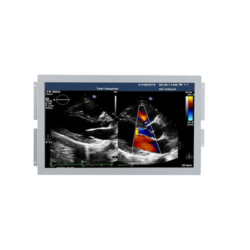 Medizinisch Monitor - U238W - Shenzhen Beacon Display Technology - für Ultraschalluntersuchungen / 1920 x 1080 / 23,8"