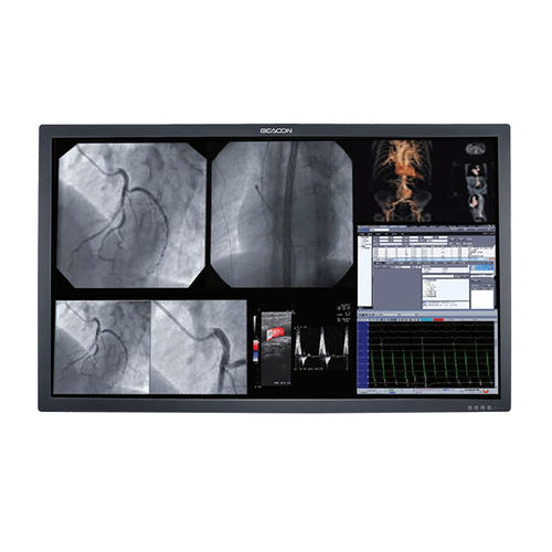 Medizinisch Monitor - S556P - Shenzhen Beacon Display Technology - 3840 × 2160 / 55" / hohe Helligkeit