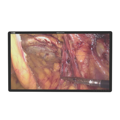 Medizinisch Monitor - S3285P-3D - Shenzhen Beacon Display Technology - für OP-Bereich / für Endoskopie / OP