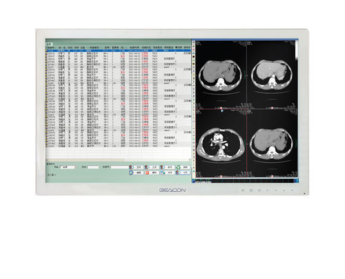 Medizinisch Monitor - HL2416SHT - Shenzhen Beacon Display Technology - hochauflösend / 24" / LED