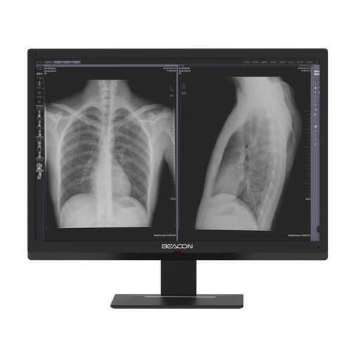 Medizinisch Monitor - C616W - Shenzhen Beacon Display Technology - hochauflösend / 30" / hohe Helligkeit