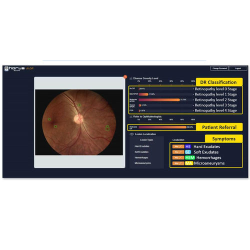 Software für Ophthalmoskopie - Medimaging Integrated Solution - Bildanalyse / Früherkennung der diabetischen Retinopathie / KI-gestützt