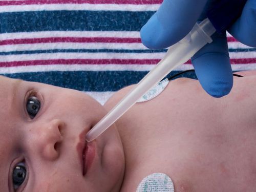 Kanüle zum Absaugen von Nasenschleim - Little Sucker® - Neotech Products - für Kinder / für Neugeborene / Latex