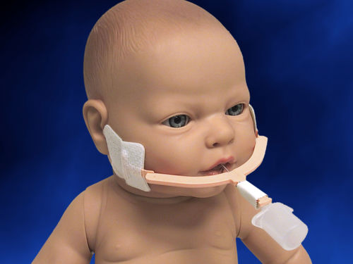Standrohr für Intubation - NeoBar® - Neotech Products