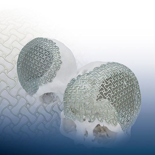 Patientenspezifisches Schädelimplantat - REAL FIT - OSTEONIC