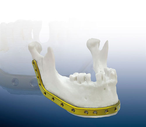 Kompressionsplatte für Unterkiefer - REAL FIT - OSTEONIC - mit Verriegelung / Titan