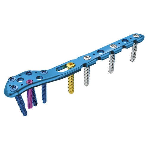 Kompressionsplatte für Humerus - SIGNEX - OSTEONIC - proximal / seitlich / mit Verriegelung