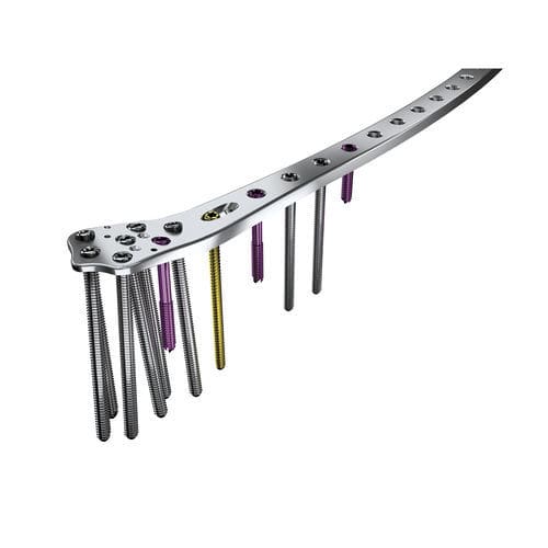 Kompressionsplatte für große Knochenfragmente - SIGNEX - OSTEONIC - proximal / seitlich / mit Verriegelung