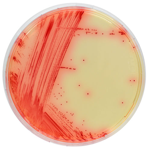 Reaktives Milieu - MB640 - CHROMagar - für Kliniken / Labor / Mycoplasma
