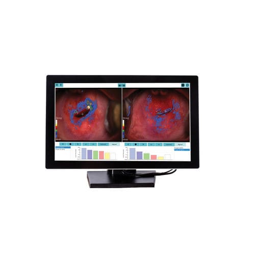 Analysesoftware - DYSISmap - DySIS Medical - Management / für Ausbildung / Bewertung