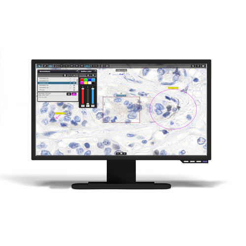 Software für virtuelle Mikroskopie - InstantViewer - 3DHISTECH Ltd. - Management / Visualisierung / Diagnose