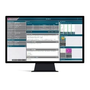 Informationssystem für Histopathologie-Labor - CaseManager DX - 3DHISTECH Ltd. - Management