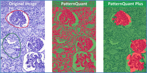 Software-Modul / Bildanalyse - PatternQuant Plus - 3DHISTECH Ltd. - Ausbildung / für Histologielabor