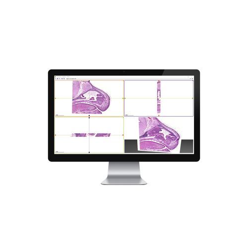 Medizinische Software - 3DView - 3DHISTECH Ltd. - Steuerung / 3D / 2D