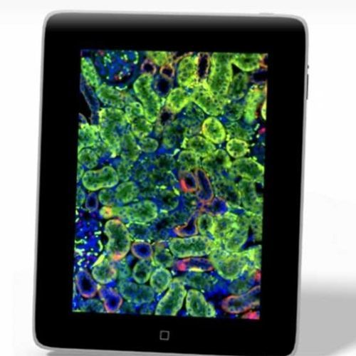 IOS-Applikation / für Histopathologie-Labor - 3DHISTECH Ltd.