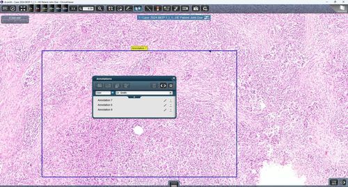 Medizinische Software - ClinicalViewer - 3DHISTECH Ltd. - für Kliniken / für Kliniken / für Telekonsultationen
