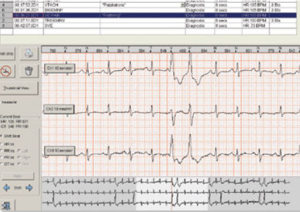 Software für Langzeit-EKG - Braemar C3000 - Braemar - Analyse / Datenverwaltung / Projektentwicklung