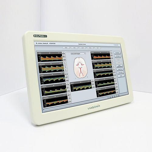Transkranieller Doppler - DOLPHIN/4D - Viasonix - Tisch / mit Touchscreen / mit Emboliedetektion