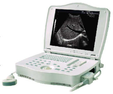 Tragbares Ultraschallgerät - LEO-3000E1  - Xuzhou Leo Medical Equipments - für Multifunktions-Ultraschall / Schwarz-Weiß / mit integrierter Konsole
