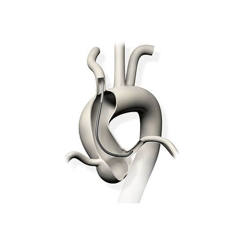 Führungskatheter - Profit™ - Nipro - Aorta / 6 FR