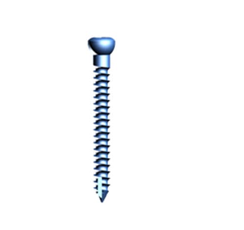 Knochen-Kompressionsschraube / für Iliosakralgelenk - 36.760 series - Medicalex - Titan
