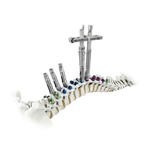 Pedikelschrauben-Positionierungssystem - CREO® Derotation - Globus Medical