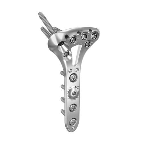 Kompressionsplatte für Radius - ANTHEM® - Globus Medical - für Handgelenk / distal / mit Verriegelung
