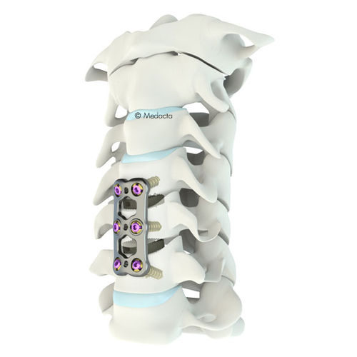 HWS-Arthrodeseplatte - Mecta®-C  - Medacta - mit Verriegelung / Metall