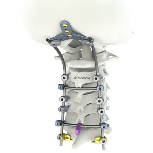 Okzipito-zervikothorakales Stabilisierungssystem für Osteosynthese - M.U.S.T. Mini - Medacta - dorsaler Zugang / für Erwachsene