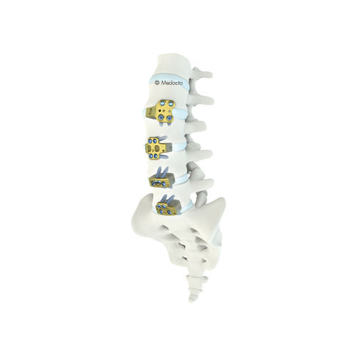 Thorako-lumbales Zwischenwirbelimplantat - MectaLIF® - Medacta - ventraler Zugang / Titan