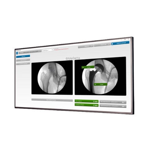 Kontrollsoftware - MyHip® - Medacta - für Hüftchirurgie / Hüfte / für Tablet-PC