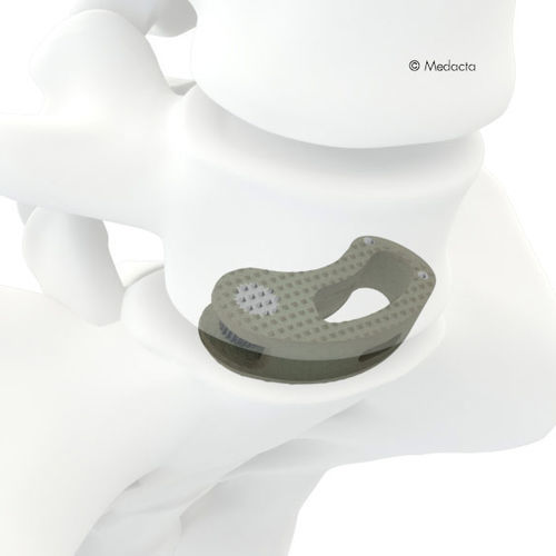 Thorako-lumbales Zwischenwirbelimplantat - MectaLIF® - Medacta - schräger Zugang / Titan / aus PEEK