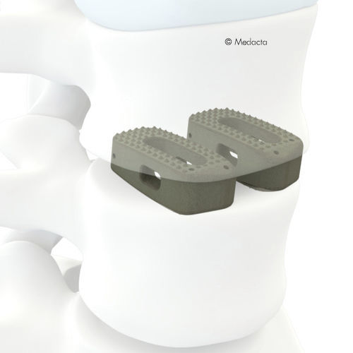 Zwischenwirbelimplantat / Brust Lendenwirbelsäule und Kreuzbein - MectaLIF® - Medacta - dorsaler Zugang / Titan / aus PEEK