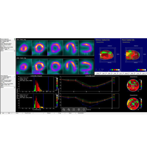 Analysesoftware - InterView™ XP - Mediso - Visualisierung / Diagnose / Mess