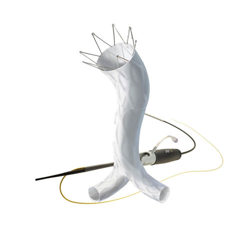 Stentgraft / Aorta abdominalis - AFX®  - Endologix - ePTFE