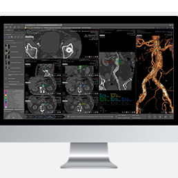 Software-Modul / Analyse - Myrian® XP-Vessel - Intrasense - Visualisierung / Planung / medizinisch