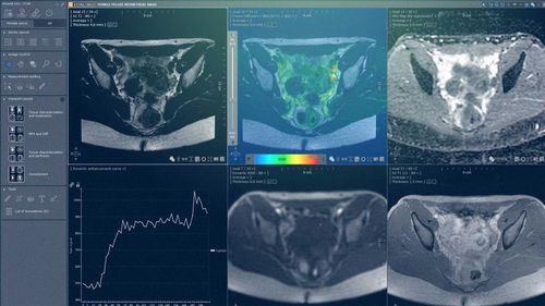 Software-Modul / Analyse - MYRIAN®XP-FEMALE - Intrasense - Visualisierung / für Kliniken / Becken