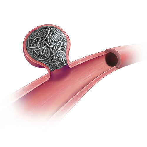 Lösbarer Embolisationsspirale - Ruby® - Penumbra