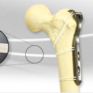 Cerclagekabel für Hüftprothesen-Revision - SuperCable&reg; Iso-Elastic&trade; - Kinamed - Multifilament-Polymer