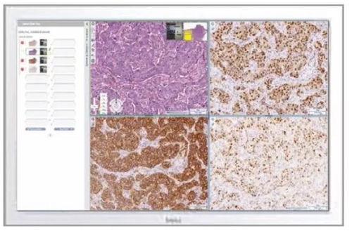 PACS für medizinische Bildgebung - Aperio eSlide Manager - Leica Biosystems - für Krankenhaus / medizinisch / für Kliniken