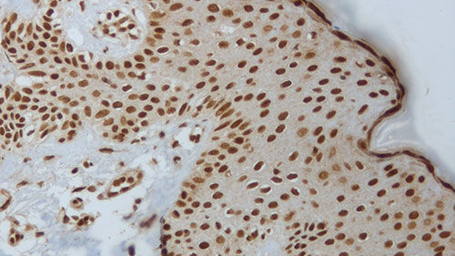 Reaktives Milieu - akt-phosphorylated - Leica Biosystems - Immunohistochimie / flüssig / Antigene