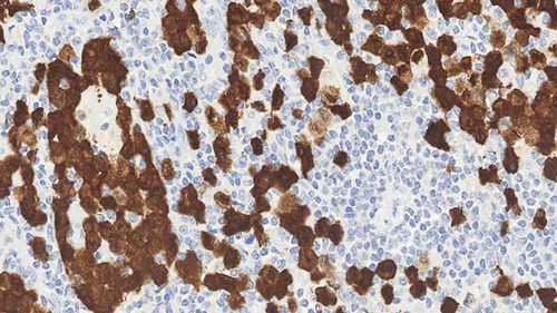 Reaktives Milieu - alk - Leica Biosystems - Immunohistochimie / Antigene