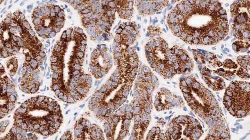 Monoklonaler Antikörper - AMACR-L-CE - Leica Biosystems - Antikörper / Immunohistochimie / flüssig