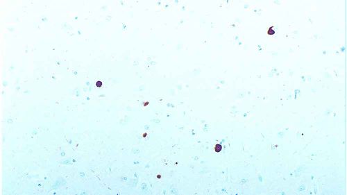 Reaktives Milieu - alpha-synuclein - Leica Biosystems - Antikörper / Immunohistochimie / Antigene
