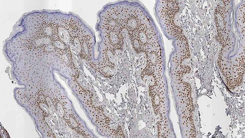 Reaktives Milieu - androgen-receptor - Leica Biosystems - Immunohistochimie / Antigene