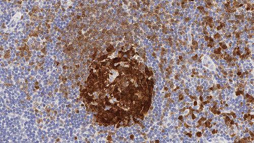 Reaktives Milieu - BOB-1-L - Leica Biosystems - Immunohistochimie