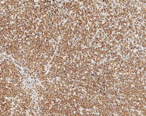 Antikörper - Bcl-2  - Leica Biosystems - monoklonaler Antikörper / Gewebe / Immunohistochimie
