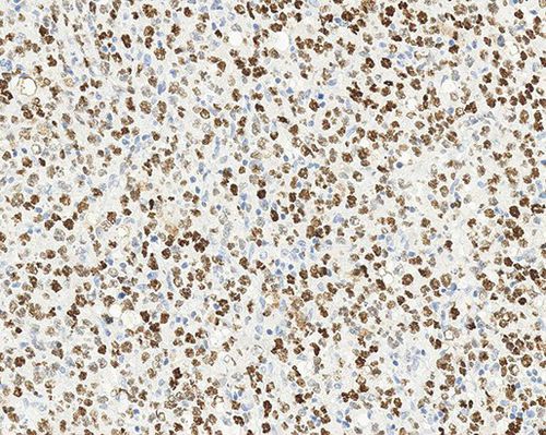 Reaktives Milieu - bcl-6-oncoprotein - Leica Biosystems - für Forschungszwecke / Immunohistochimie / flüssig